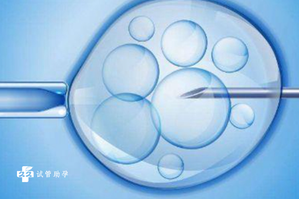 脑袋开窍是真的！研究表明：学习时大脑皮层存在“灵光一现”机制